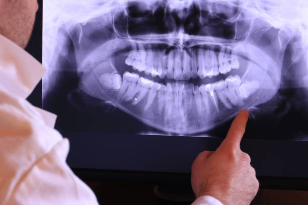 Best Emergency Treatment for Toothache in Lake Shore, MD